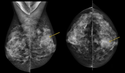 2009 11 29 17 04 46 219 Elasto Destounis Top 450