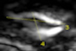 2009 11 29 17 04 47 435 Elasto Destounis Thumb