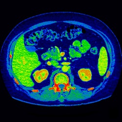 2009 11 30 10 47 14 666 Image 5 Mono Color Map
