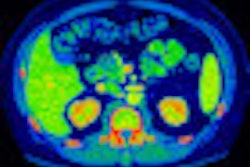 2009 11 30 10 58 05 825 Image 5 Mono Color Map Thumb