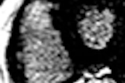 2009 11 30 15 50 18 952 Donati thumb 11 09