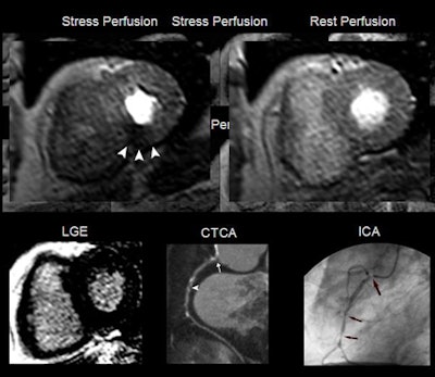 2009 11 30 21 10 24 705 Donati pt Vnew