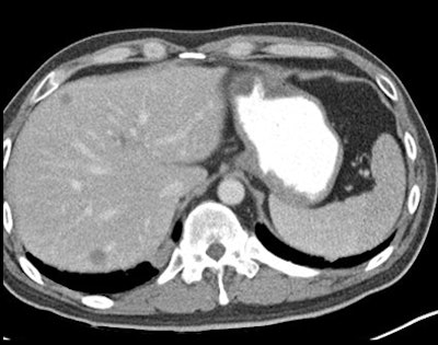 2009 12 02 16 21 05 965 Macari 120kvp bottom