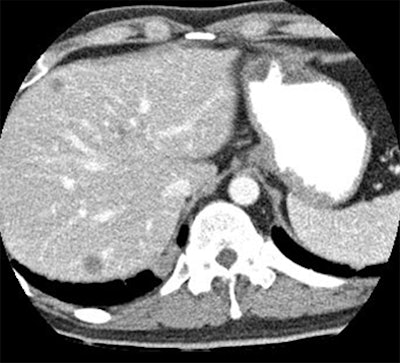 2009 12 02 16 21 11 626 Macari 80kvp top