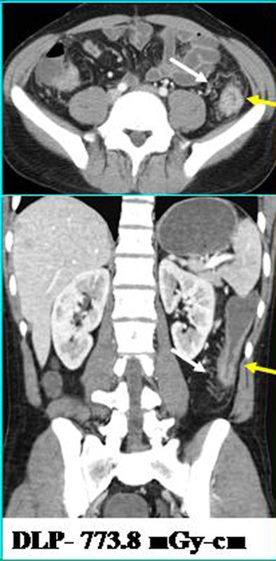 2009 12 03 16 20 08 640 Singh fbptop 394