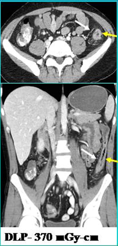 2009 12 03 16 20 13 29 Singh asirbottom 394