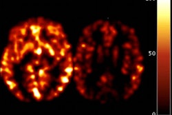 2009 12 07 17 26 20 303 Raji Mri 394