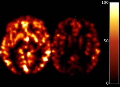 2009 12 07 17 26 20 303 Raji Mri 394