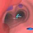 2009 12 11 14 59 36 837 Bronchus Bai Thumb