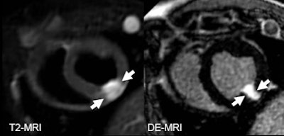 2009 12 16 11 45 43 173 Mahnken mri top