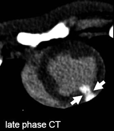 2009 12 16 11 45 48 119 Mahnken bottom latephase ct