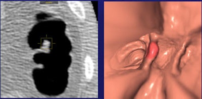 2009 12 22 14 12 38 321 Regge 59yearold