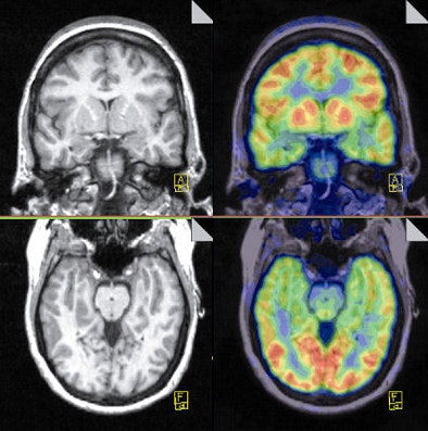 2009 12 23 13 56 43 358 Talanow Mri Pet Images Merged 394