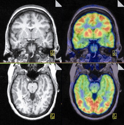 2009 12 23 13 56 43 358 Talanow Mri Pet Images Merged 394