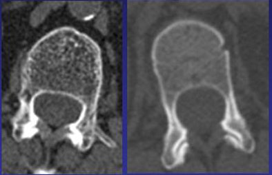 2009 12 28 11 44 59 161 Summers l1body