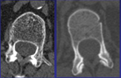 2009 12 28 11 44 59 161 Summers l1body