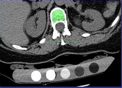2009 12 28 11 45 05 751 Summers automated