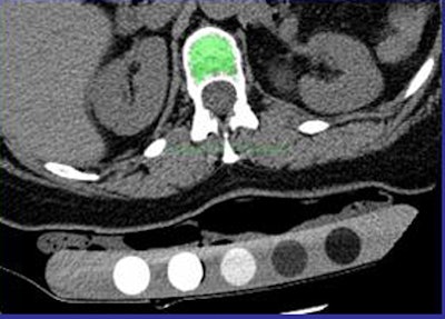 2009 12 28 11 45 05 751 Summers automated