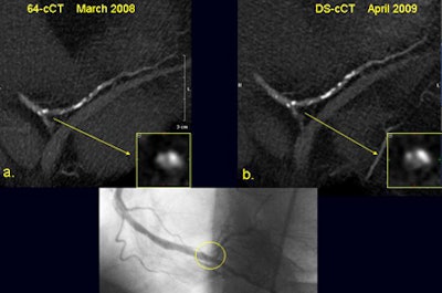 2010 01 07 15 38 33 557 Galea image1