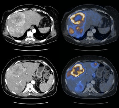 2010 01 08 16 42 42 734 Veit Papillary Carcinoma 450