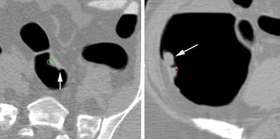 2010 01 13 15 25 03 814 Robinson examples