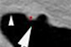 2010 01 13 15 25 09 994 Robinson thumb 01 10