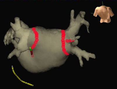 2010 01 14 14 38 14 505 Uva Image B 394