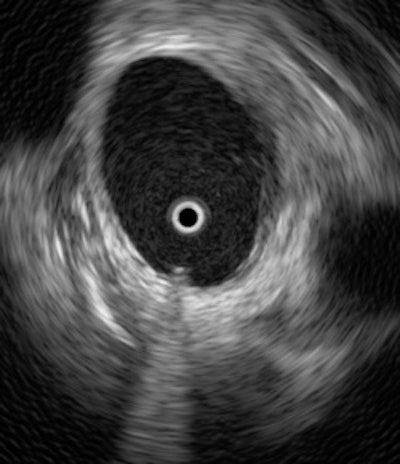 2010 01 14 14 38 18 567 Uva Image A 250