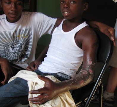 2010 01 22 12 25 36 805 Haiti2 394