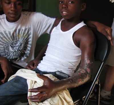 2010 01 22 12 25 36 805 Haiti2 394