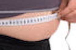 2010 01 22 14 37 29 193 Obesity 70