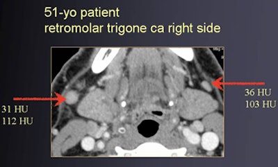 2010 01 22 15 05 46 271 Trojanowska case1 top