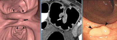 2010 01 26 15 05 03 449 Park case3