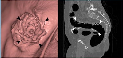 2010 01 26 15 05 05 65 Park 58yearold