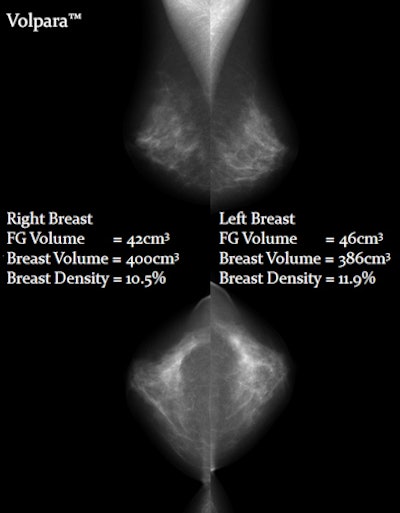 Calibrated Digital Mammography Scale