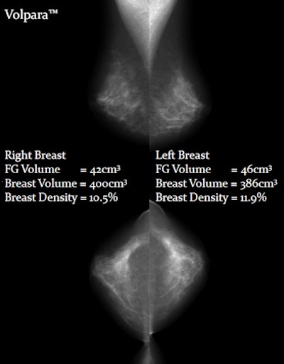 2010 01 29 11 29 36 395 Volpara Breast Density 394