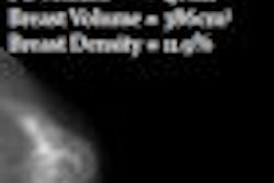 2010 01 29 11 29 37 399 Volpara Breast Density Thumbail