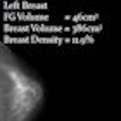 2010 01 29 11 29 37 399 Volpara Breast Density Thumbail