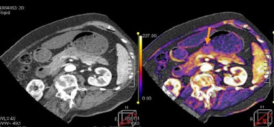 2010 02 02 16 23 28 722 Kandel image3