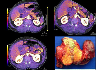 2010 02 02 16 23 35 731 Kandel image2