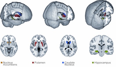2010 02 03 16 35 39 288 Mri Video 01 450