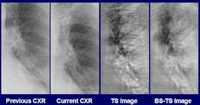 2010 02 05 12 20 03 882 Dual Energy1 Export 390