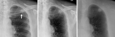 2010 02 05 12 41 22 845 Brice Dual Energy Fig2abc 450