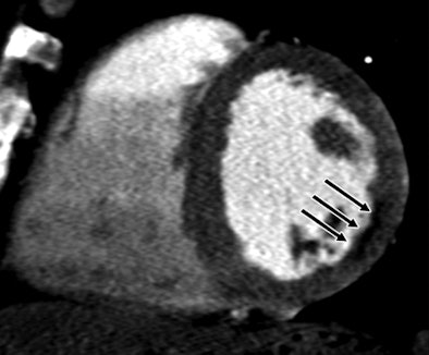 2010 02 05 17 45 44 340 Rocha2b 394