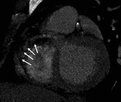 2010 02 05 17 45 48 794 Rocha2a 394