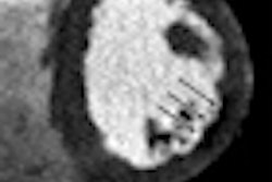 2010 02 05 17 53 28 634 Rocha Thumb
