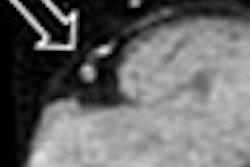 2010 02 08 13 42 26 356 Arnoldi thumb 01 10