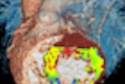 2010 02 09 14 46 23 164 Schoepf thumb 02 10