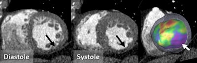 2010 02 09 14 53 58 268 Schoepf picture7x