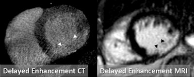 2010 02 09 14 54 03 735 Schoepf picture5x